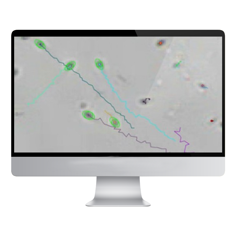 Анализатор спермы Mecos Meco-Sperm