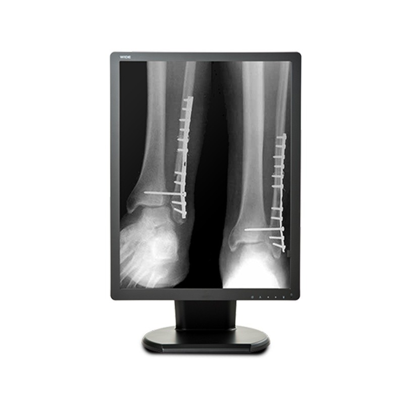 Медицинский монитор Double Black Imaging 2MP Monochrome