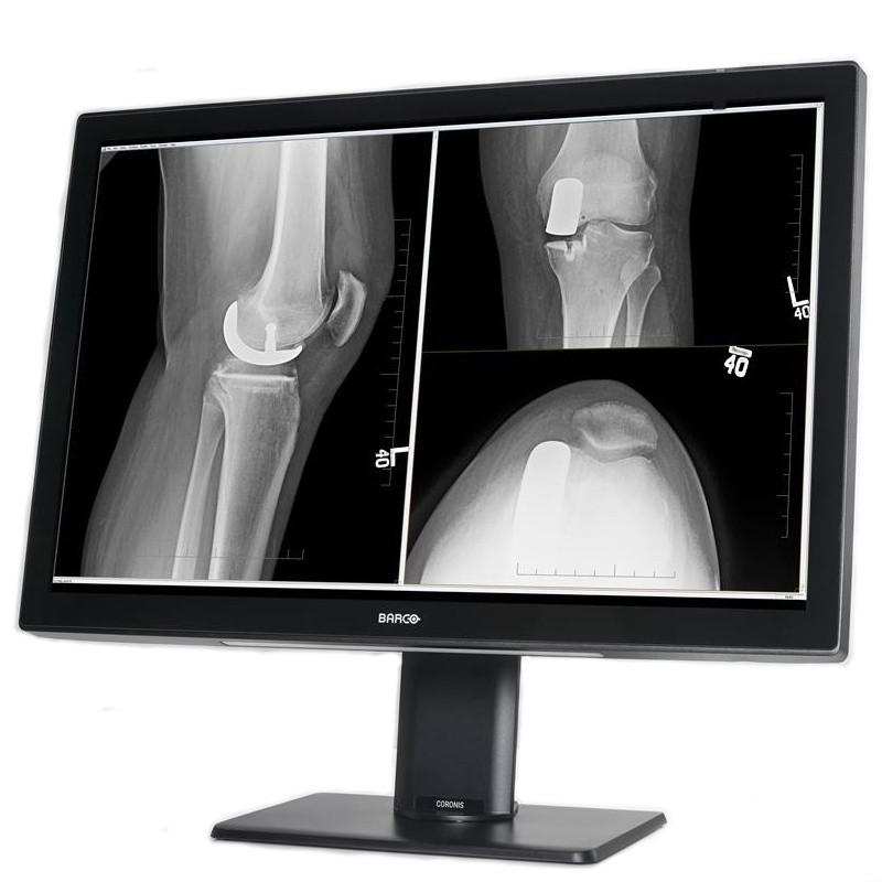 Медицинский монитор Barco Coronis Fusion 4MP MDCC-4430