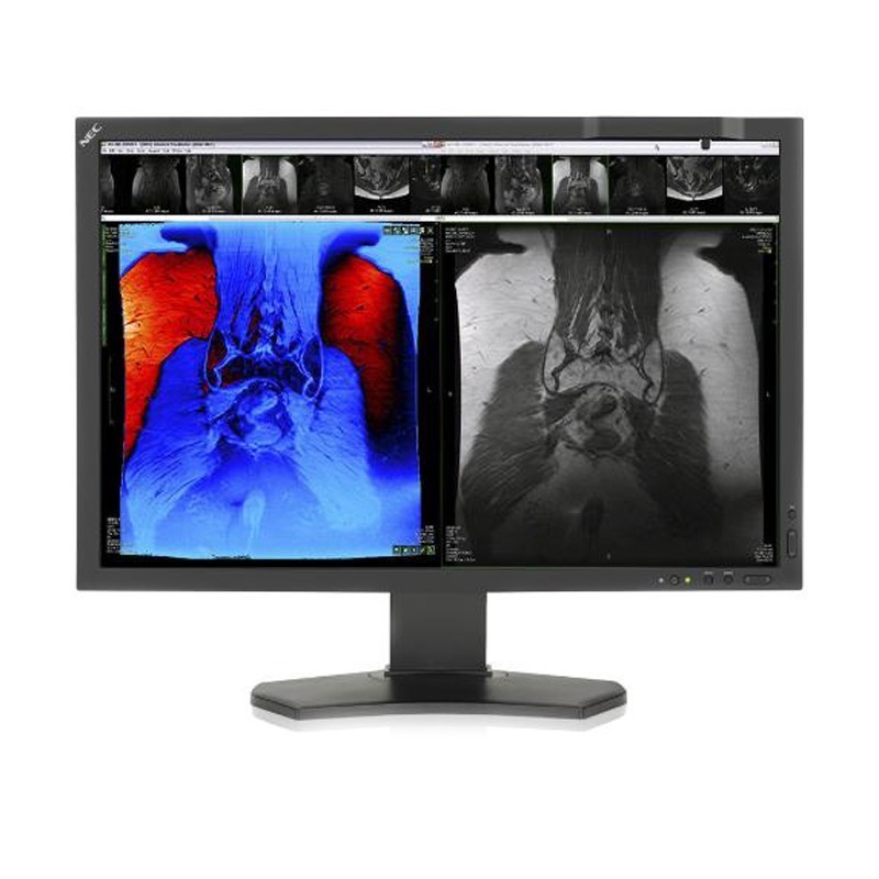 Медицинский монитор NEC MD242C2