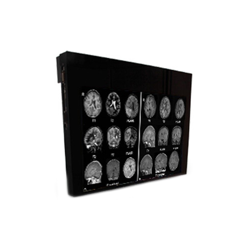 Медицинский монитор Double Black Imaging 32" MRSafe Display