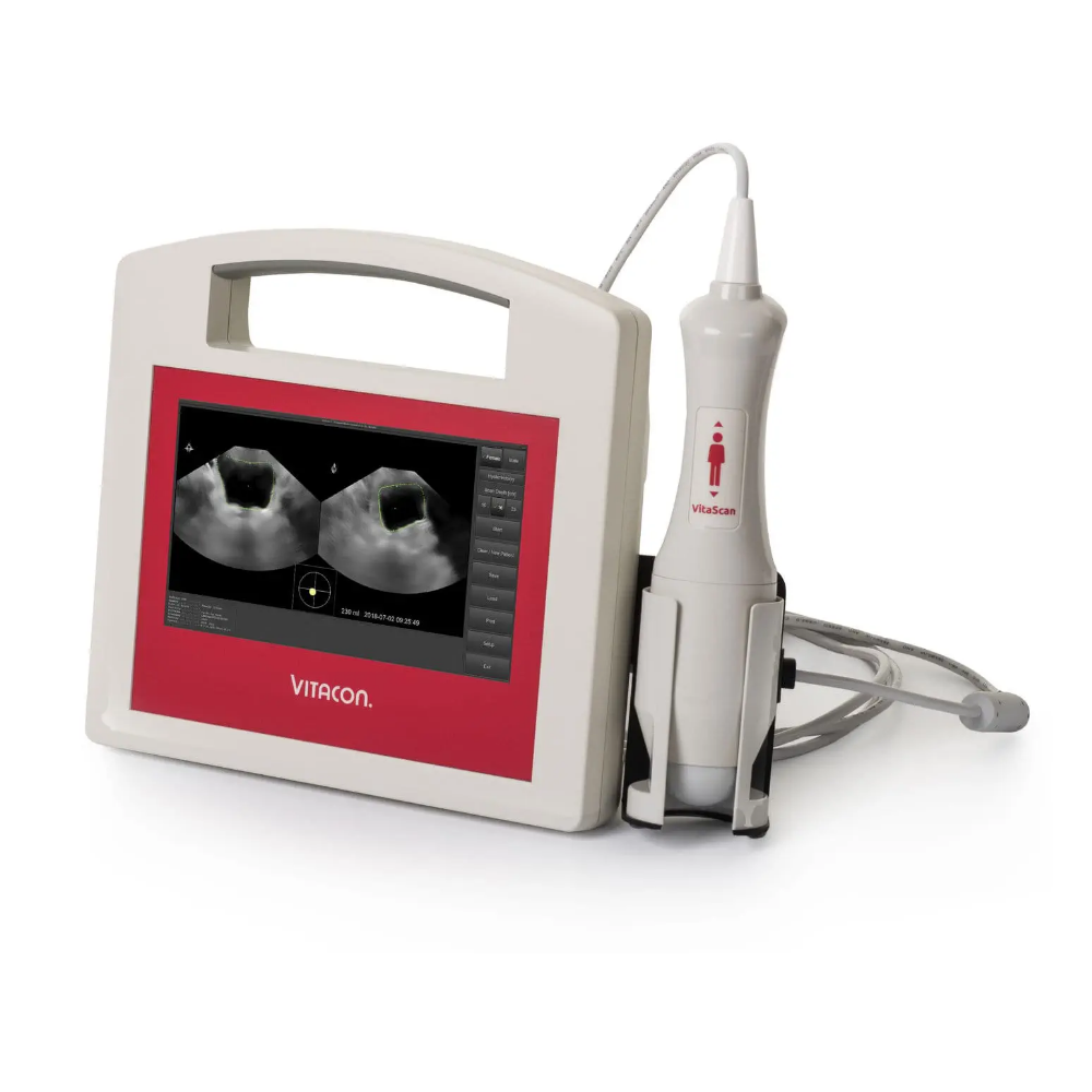 Сканер мочевого пузыря Vitacon VitaScan PD - 100570CP