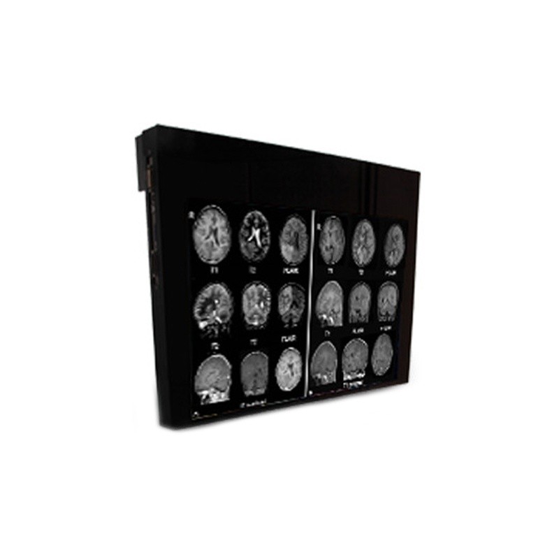 Медицинский монитор Double Black Imaging 24" MRSafe Display