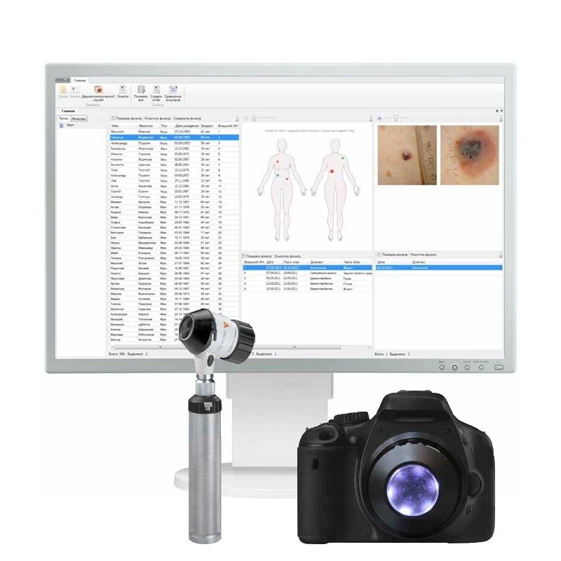 Программное обеспечение для дерматоскопии Heine Vision Derma