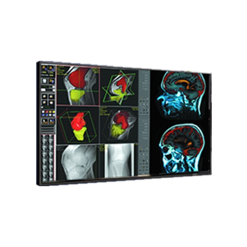 Медицинский монитор Double Black Imaging 42" Professional LCD