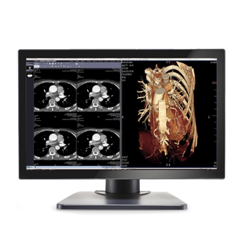 Медицинский монитор Double Black Imaging Image Systems Gemini 4MP Large Format Display