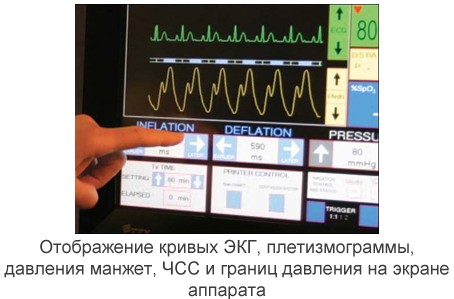 Аппарат усиленной наружной контрпульсации Chongqing PSK-Health P-ECP/TI (КНР)