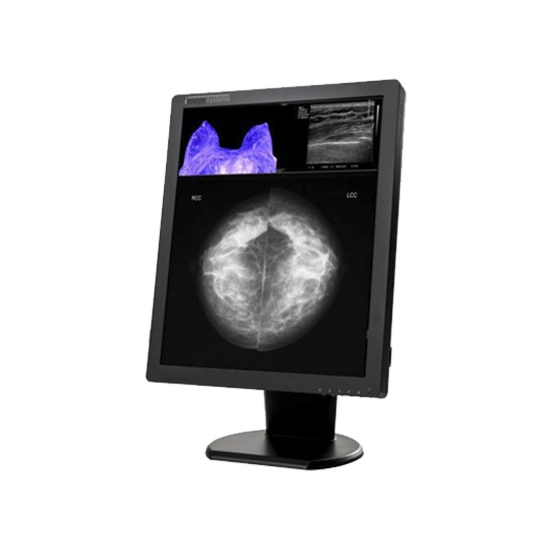 Медицинский монитор Double Black Imaging Image Systems 5MP Color Diagnostic Display (C5MPN)
