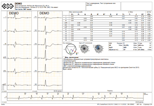 Модуль SDS для BTL CardioPoint