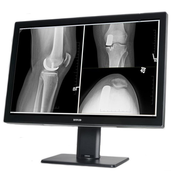 Медицинский монитор Barco Coronis Fusion 4MP MDCC-4430
