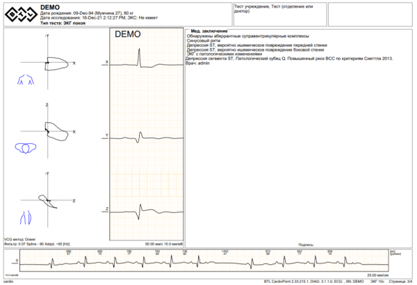 Модуль SDS для BTL CardioPoint