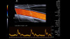 Аппарат УЗИ (сканер) Siemens Healthineers Acuson Sequoia