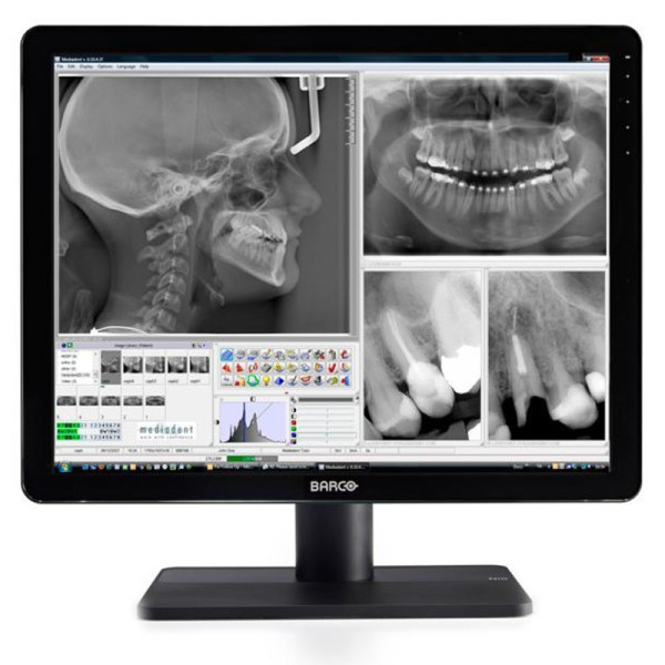 Медицинский монитор Barco Nio Color 3MP Dental