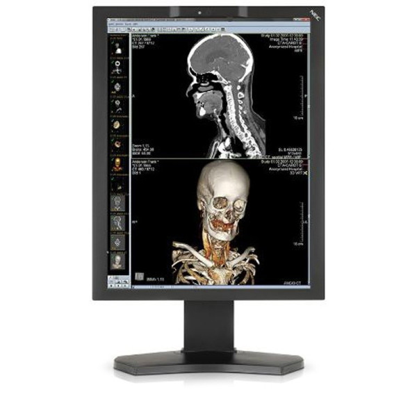 Медицинский монитор NEC MD210C2