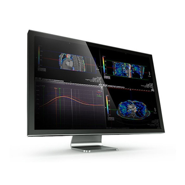 Цифровая консоль и рабочая станция врача Canon Vitrea