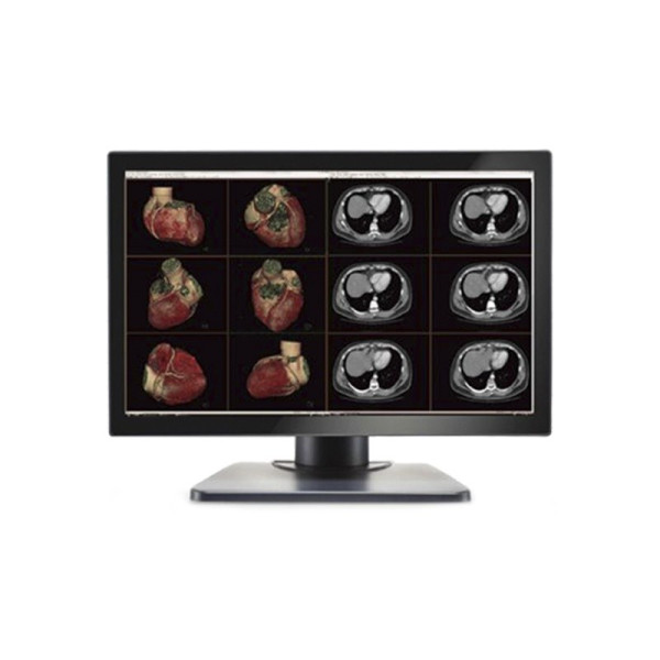Медицинский монитор Double Black Imaging Image Systems Gemini 6mp Large Format Display