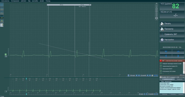 Программа для ЭКГ покоя BTL CardioPoint-ECG C600