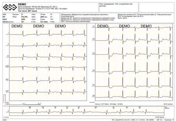 Модуль SDS для BTL CardioPoint