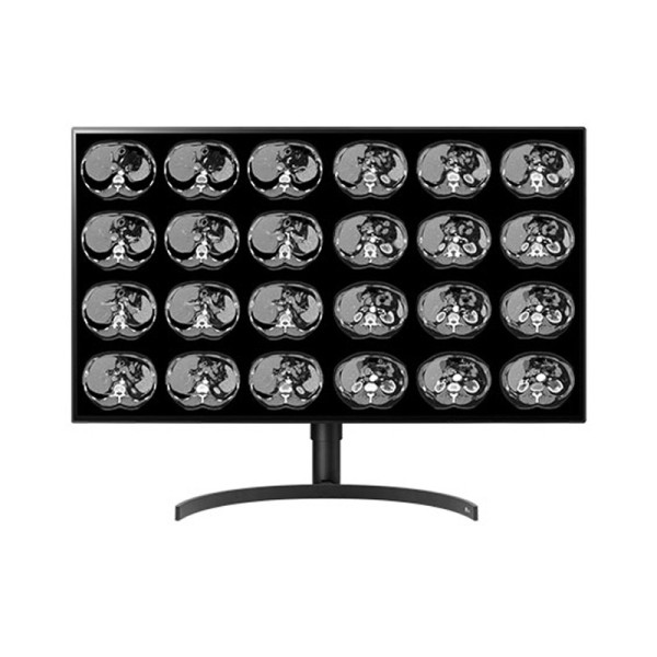 Медицинский монитор Double Black Imaging 32" Color 8MP Large Format Display