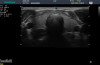 Аппарат УЗИ (сканер) Sonoscape S20 Exp