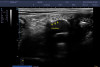 Аппарат УЗИ (сканер) Sonoscape S2N