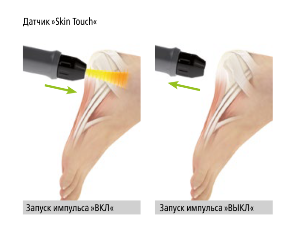 Аппарат ударно-волновой терапии STORZ MEDICAL MASTERPULS MP100