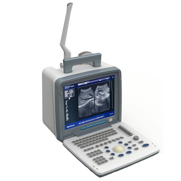 Ультразвуковой сканер Promed Group DP-6800