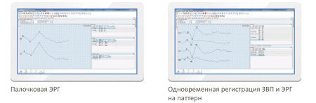 Электроретинограф Нейрософт Нейро-ЭРГ