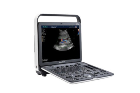 Аппарат УЗИ (сканер) Sonoscape S8 Exp Vet