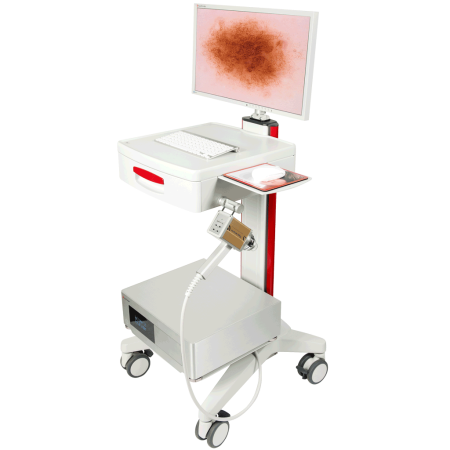Дерматоскоп FotoFinder Dermoscope Vexia