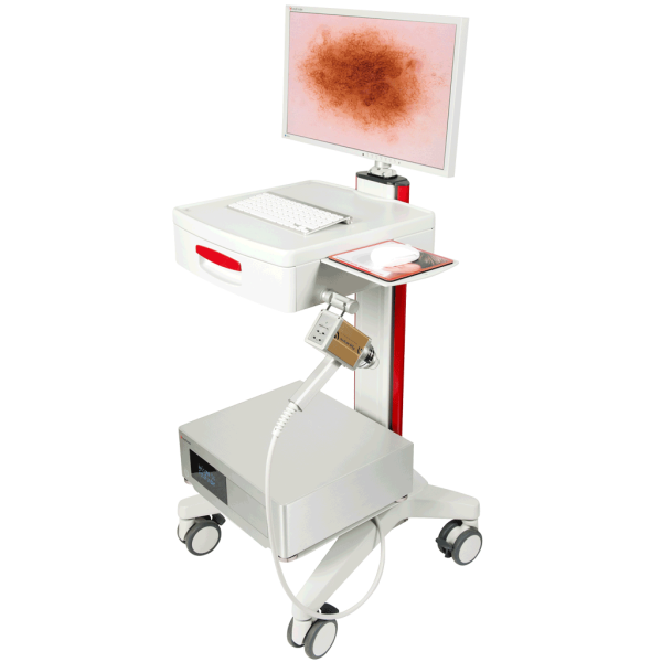 Дерматоскоп FotoFinder Dermoscope Vexia