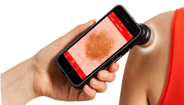 Дерматоскоп FotoFinder Handyscope