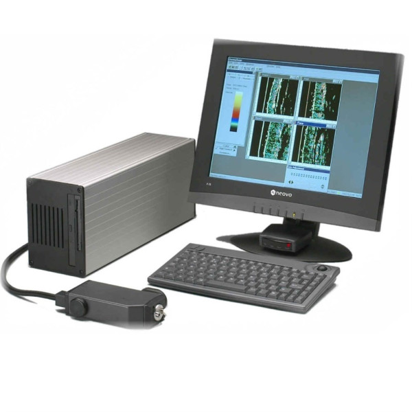 Дерматоскоп Cortex Technology DermaScan C 3D