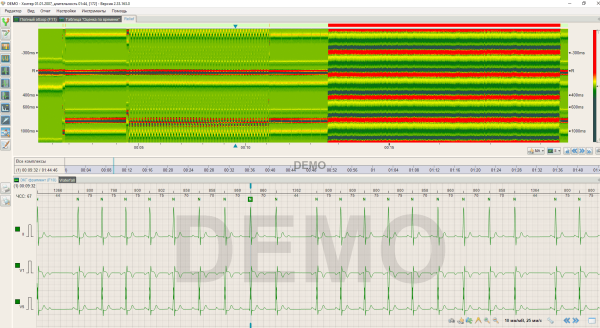 Программа для ЭКГ по Холтеру BTL CardioPoint-Holter