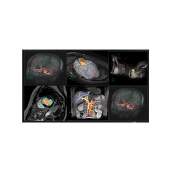 Медицинский монитор Double Black Imaging 60" Professional LCD