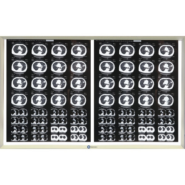 Двухкадровый негатоскоп Негатоскоп.ру