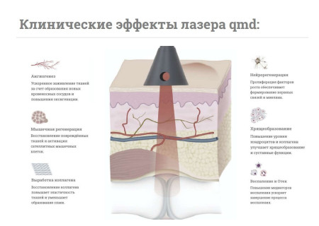 Аппарат физиотерапевтический многофункциональный QMD Helios Cryo-thermal