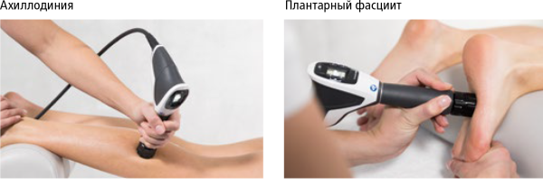 Аппарат ударно-волновой терапии STORZ MEDICAL MASTERPULS MP50