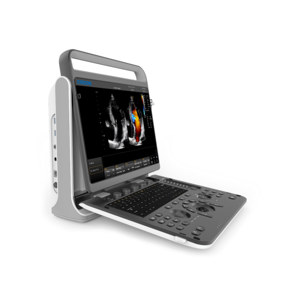 Аппарат УЗИ (сканер) Chison SonoTouch 60 Pro