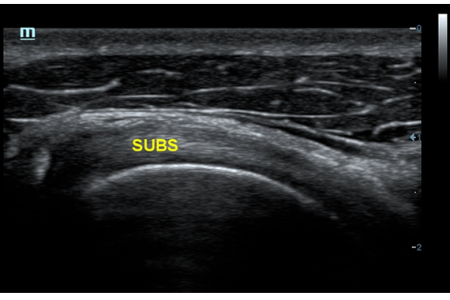 Аппарат УЗИ (сканер) Mindray DC-60 Exp