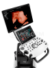 УЗИ Аппарат Mindray Consona N6