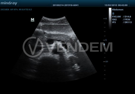 Аппарат УЗИ (сканер) Mindray DP-50 Vet