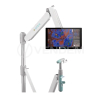 Кольпоскоп Dysis Medical Colposcope