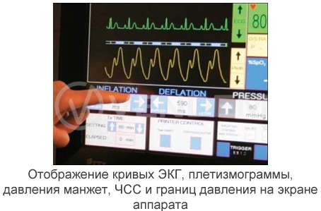 Аппарат усиленной наружной контрпульсации Chongqing PSK-Health P-ECP/TI (КНР)