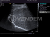 Аппарат УЗИ (сканер) Siemens Healthineers Acuson S2000