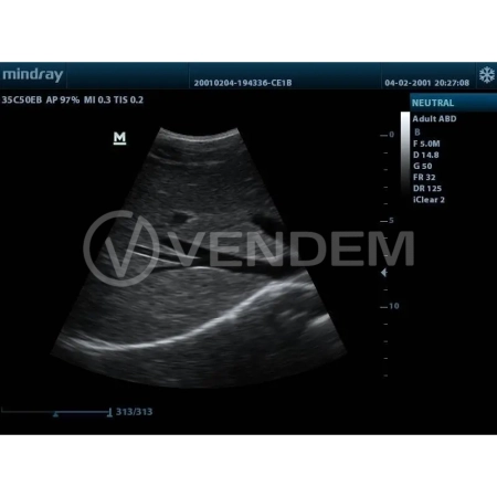 Аппарат УЗИ (сканер) Mindray DP-20 Vet